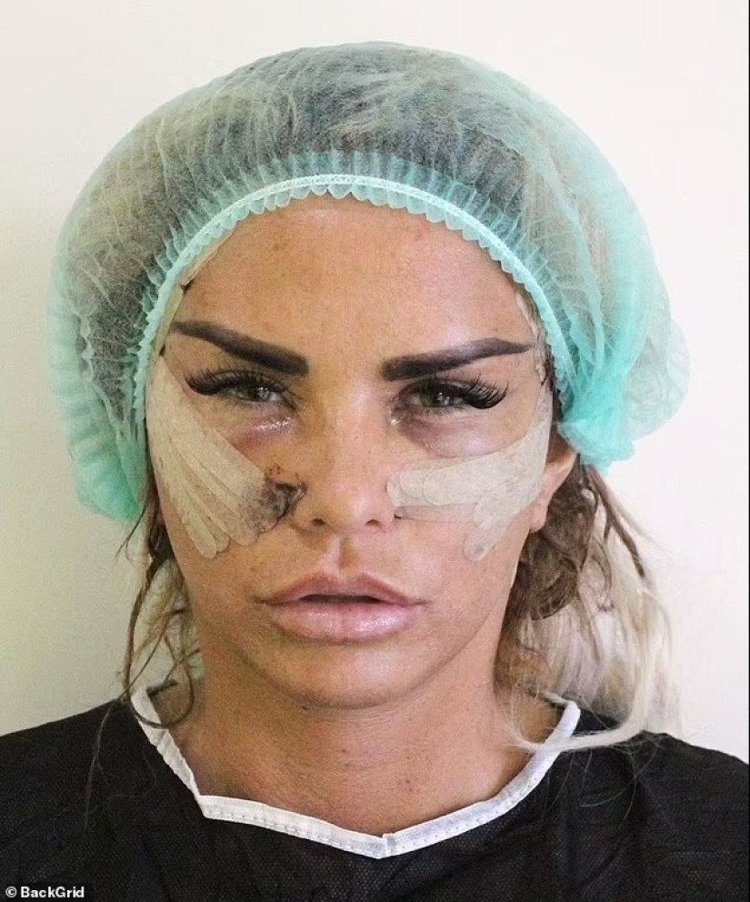 Katie Price shocks as she reveals the results of her 'bum lift' in TINY black thong
