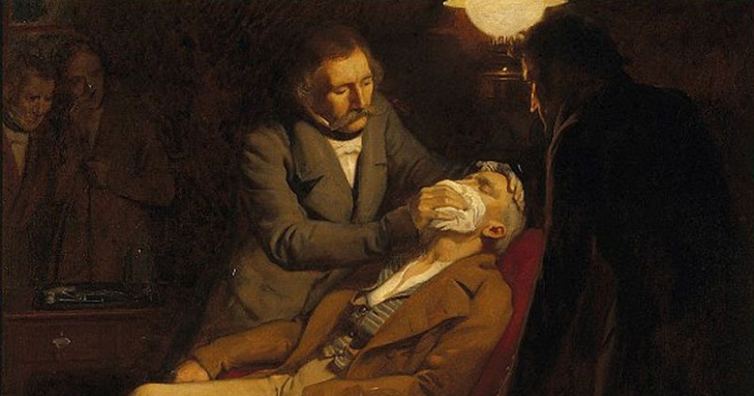 La terrible historia de la anestesia, desde la raíz de mandrágora y la estrangulación, hasta la aparición del éter