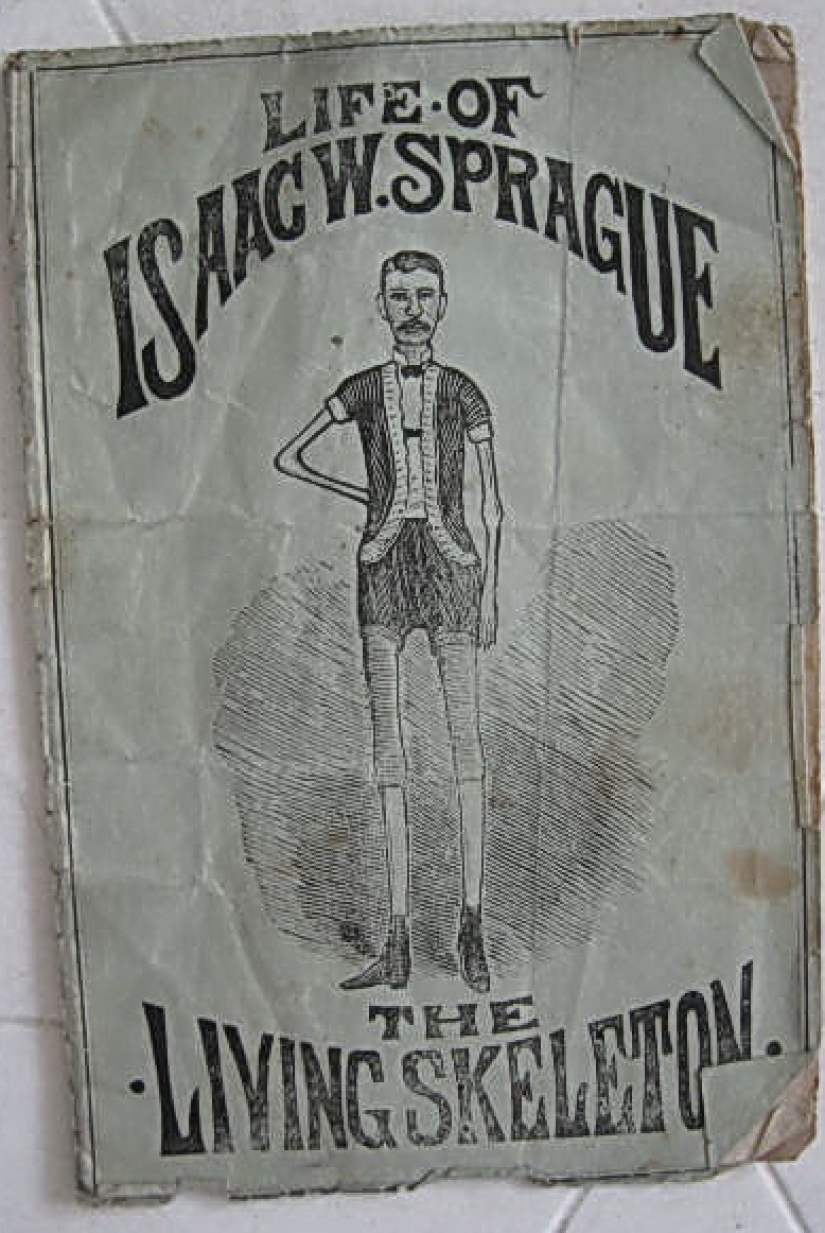 La trágica historia del &quot;esqueleto viviente&quot; Isaac Sprague