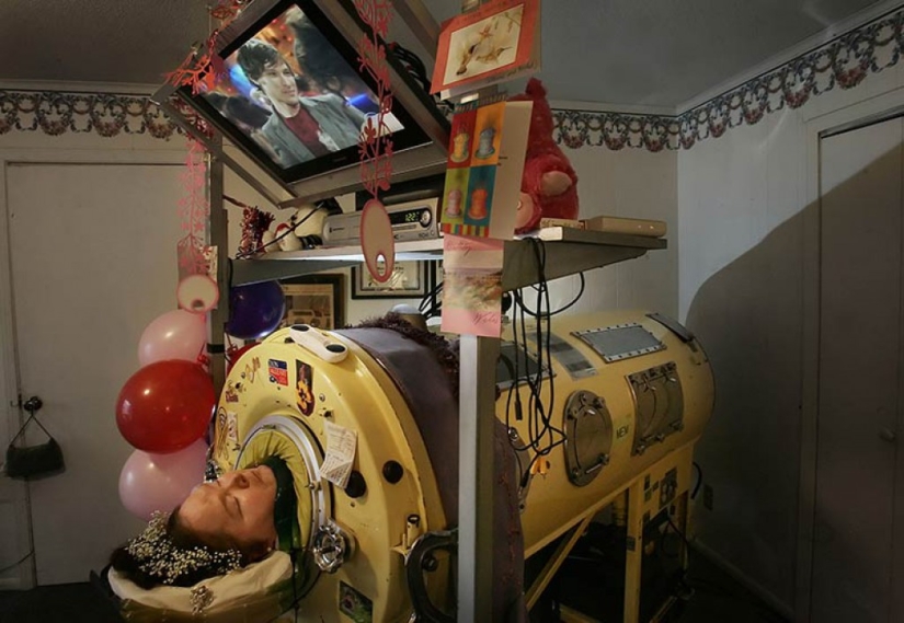 La vida en el "tanque": una mujer que ha pasado casi 60 años en el pulmón