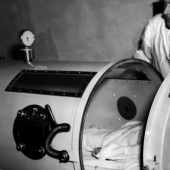Los prisioneros de la "pulmón de Hierro": cómo rescatar a las víctimas de la poliomielitis, han olvidado cómo respirar
