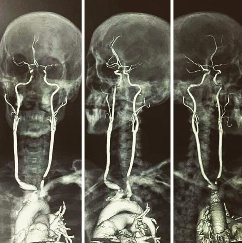 Mejor que cualquier libro de texto: más de 20 imágenes sobre anatomía humana que te sorprenderán