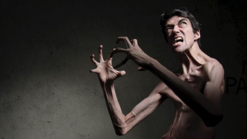 No se le conoce solo de vista: Javier Botet es un actor que interpreta monstruos