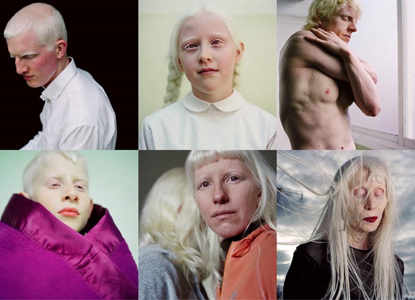 Paola de Grene's Albinos