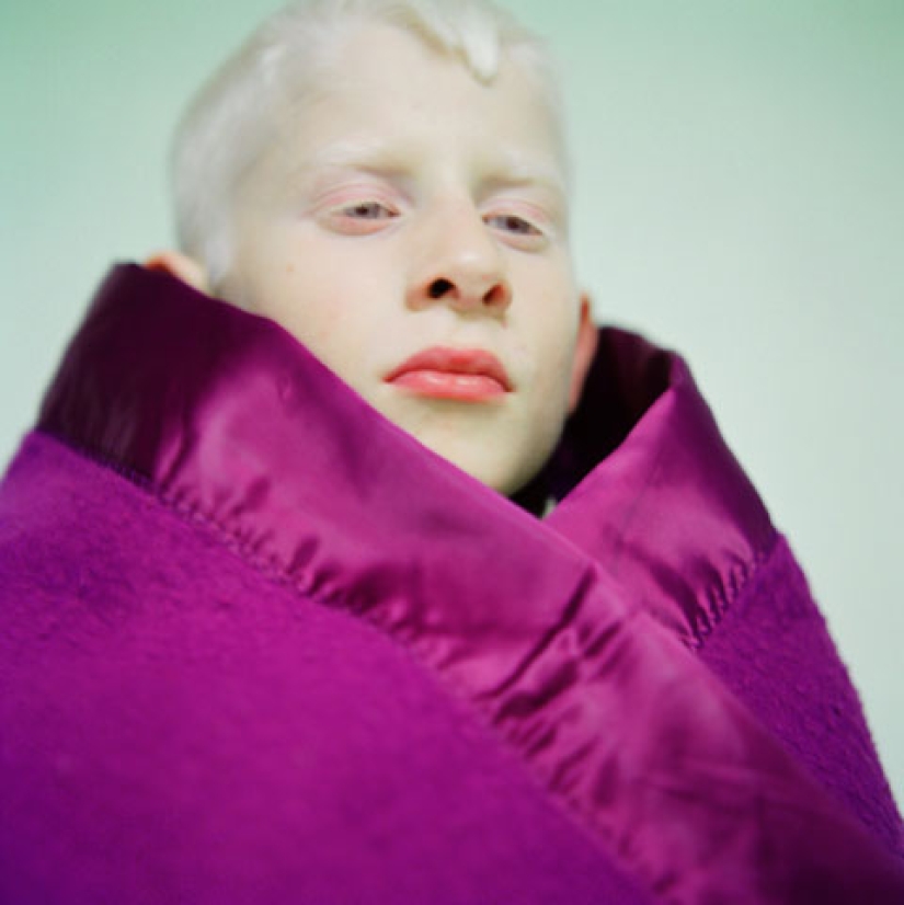 Paola de Grene's Albinos