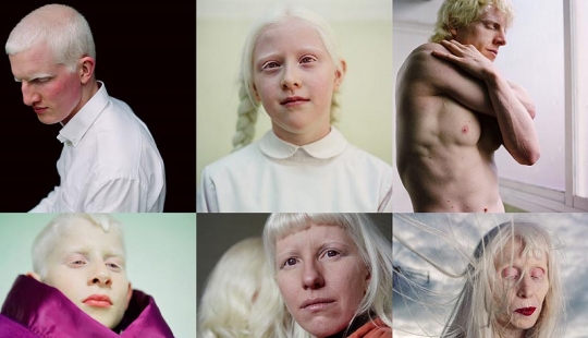 Paola de Grene's Albinos