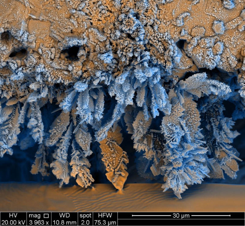 Photos taken with an electron microscope