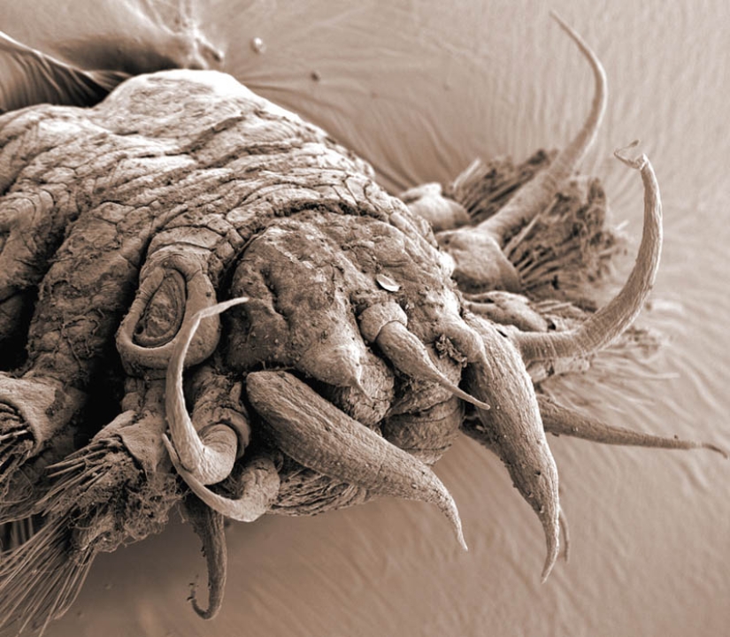 Photos taken with an electron microscope