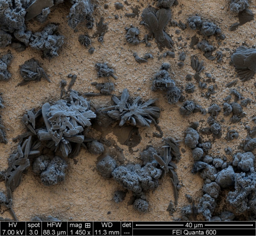 Photos taken with an electron microscope