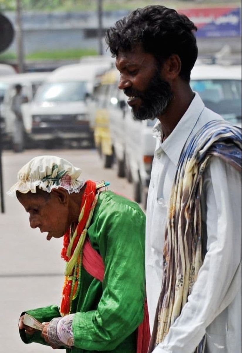 "Rats of Shah Daula": children from Pakistan with deformed skulls and a hard fate