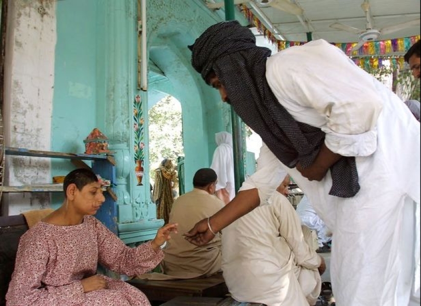 "Rats of Shah Daula": children from Pakistan with deformed skulls and a hard fate