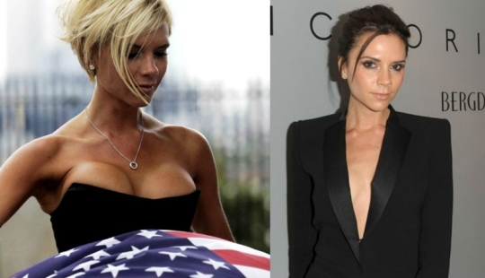 See above: Stars who have had breast reduction surgery