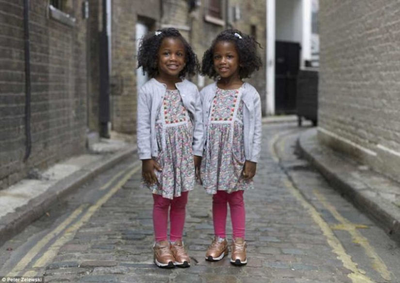 So similar, but so different: 20 incredible portraits of twins