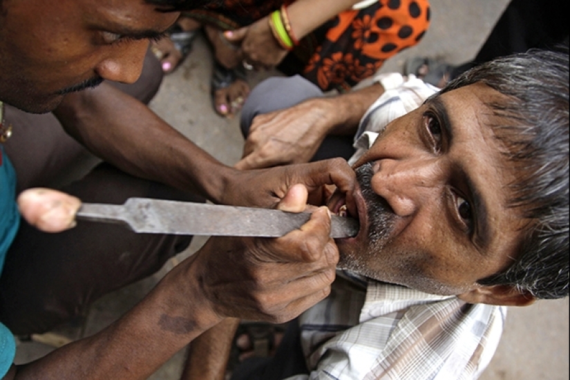 Street dentists in India: service for the brave and not squeamish