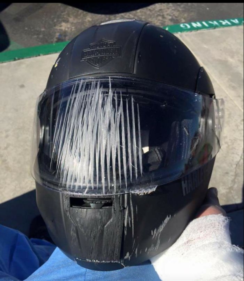 Take care of your head: accident victims shared photos of helmets that saved their lives