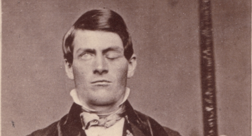 The amazing story of Phineas Gage - the man with the crowbar in his skull