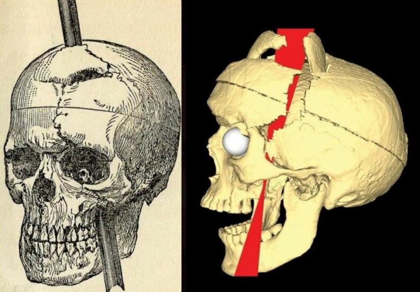 The amazing story of Phineas Gage - the man with the crowbar in his skull