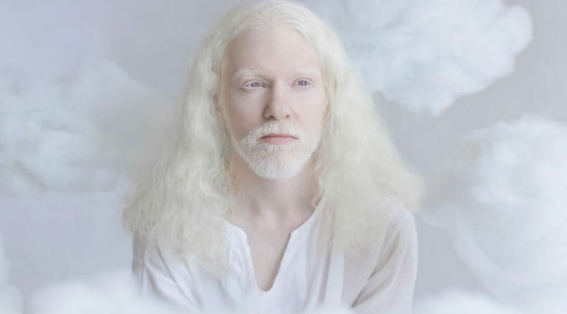 The hypnotic beauty of albinos in the photo project of Yulia Taits