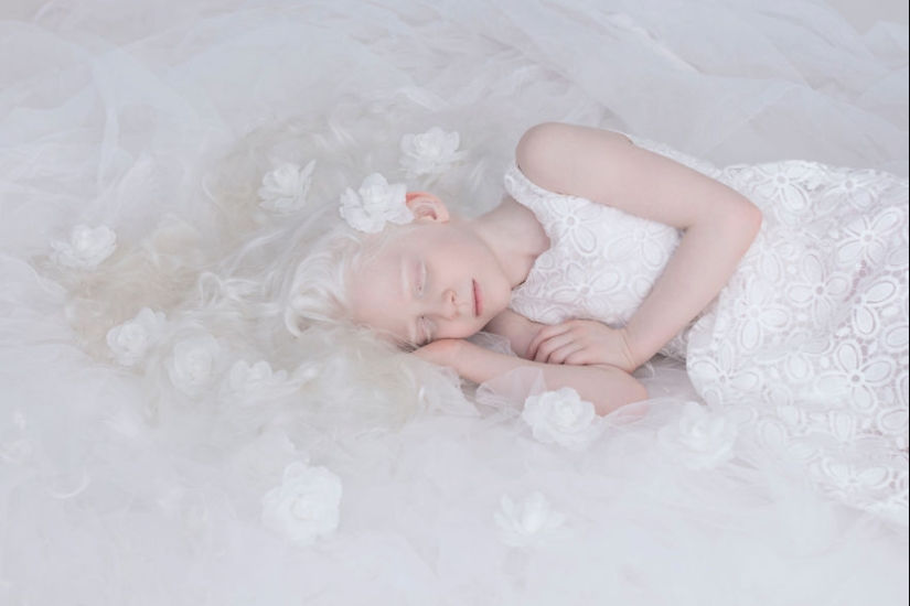 The hypnotic beauty of albinos in the photo project of Yulia Taits