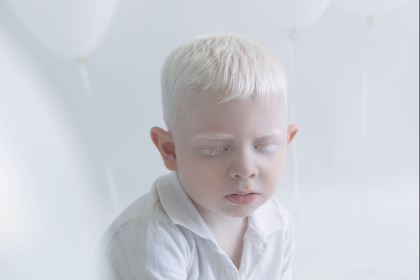 The hypnotic beauty of albinos in the photo project of Yulia Taits