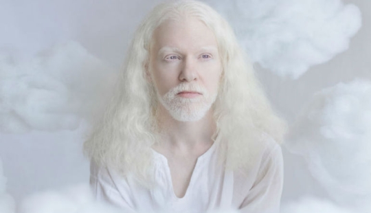 The hypnotic beauty of albinos in the photo project of Yulia Taits