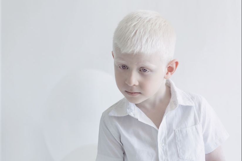 The hypnotic beauty of albinos in the photo project of Yulia Taits