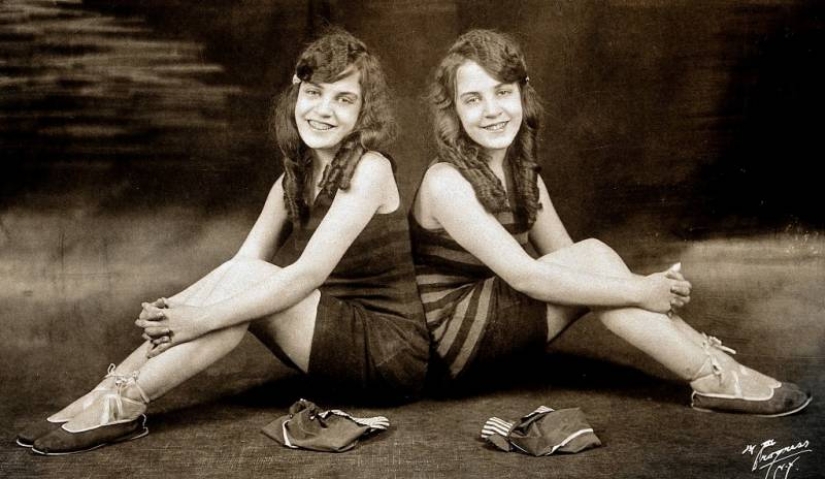 The life of Siamese twins Daisy and Violet Hilton