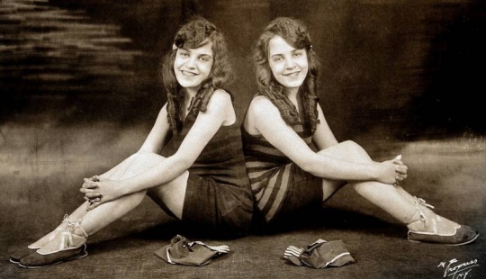 The life of Siamese twins Daisy and Violet Hilton