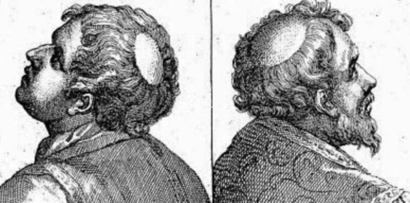 The secret of the Tonsure: why Catholic monks shaved the top of their heads