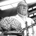 The story of a head transplant that was never meant to happen