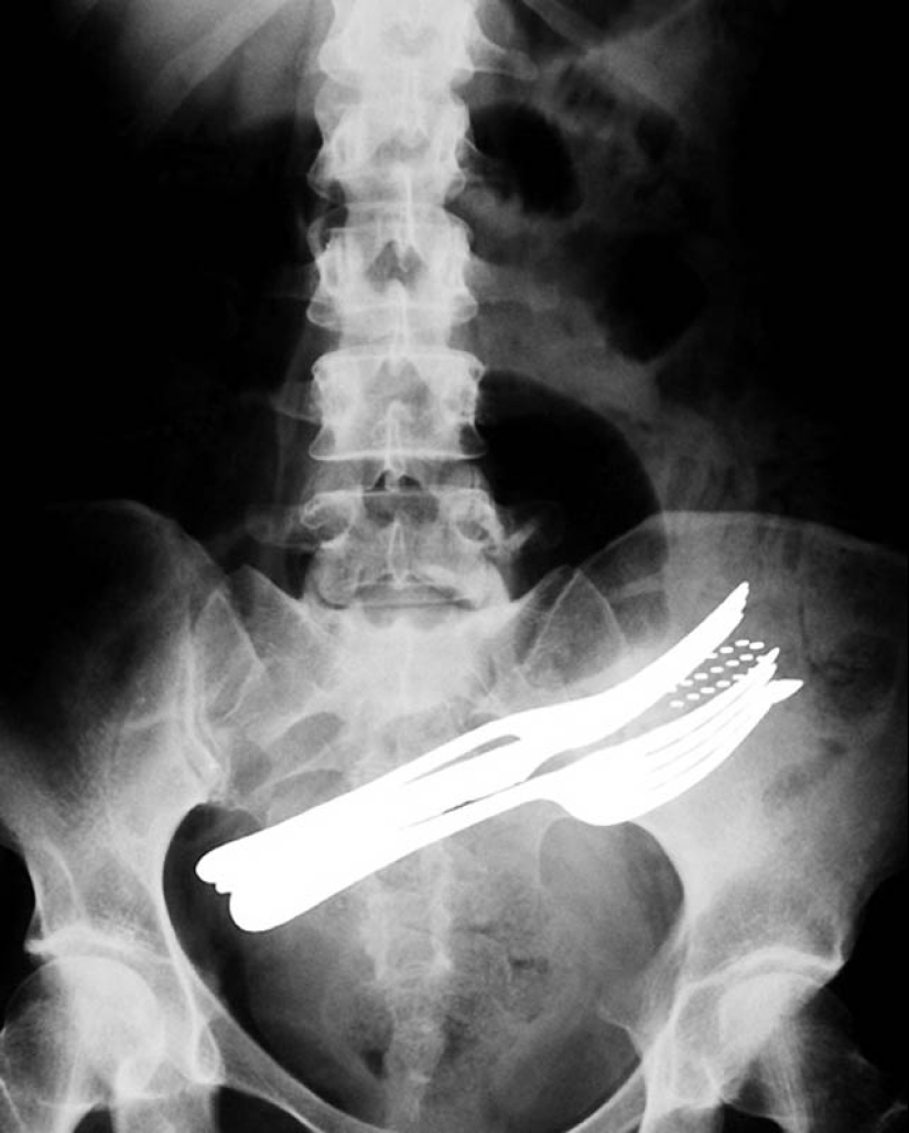 The strangest X-rays