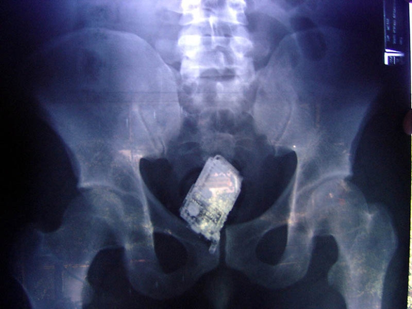 The strangest X-rays