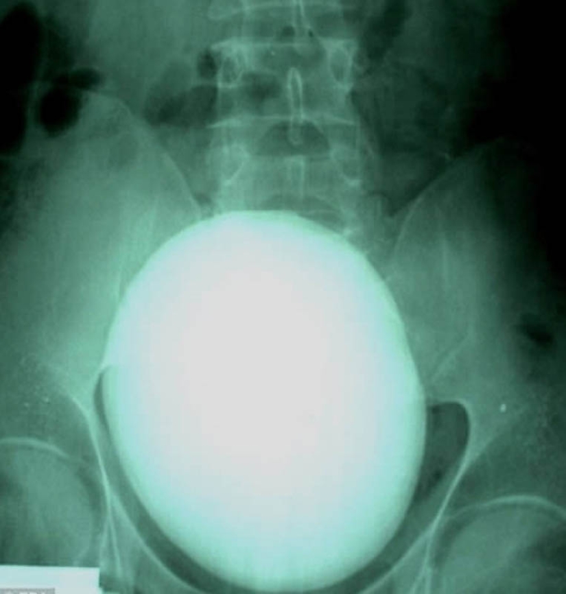 The strangest X-rays