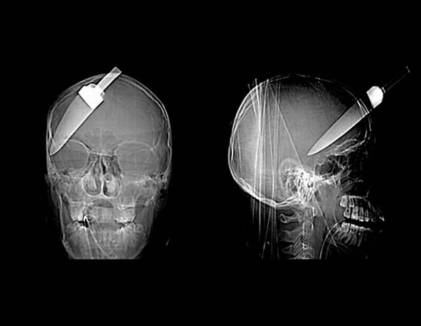 The strangest X-rays