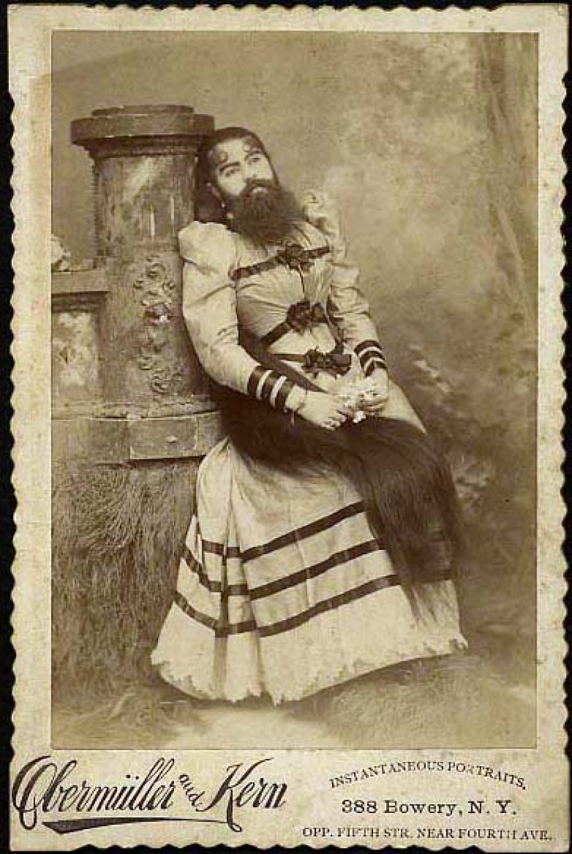 The tragic life of bearded women Annie Jones, who was a real lady