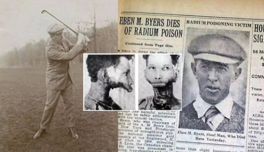 The tragic story of Eben Byers, who was treated with radium