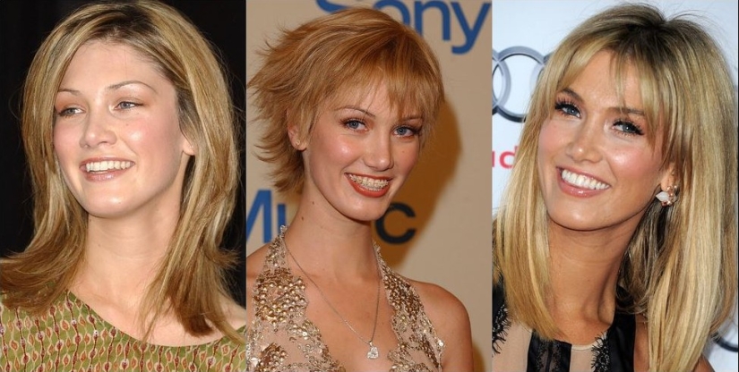 These celebrities will show you how braces can dramatically change your smile.