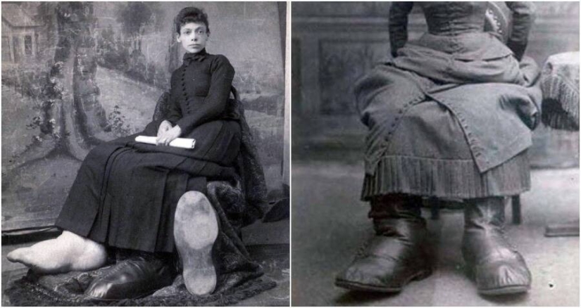 Ugliness eternal seal: the tragic fate of the "girl with big feet from Ohio"