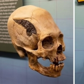 Un cráneo humano unido con metal hace 2000 años sorprendió a los científicos
