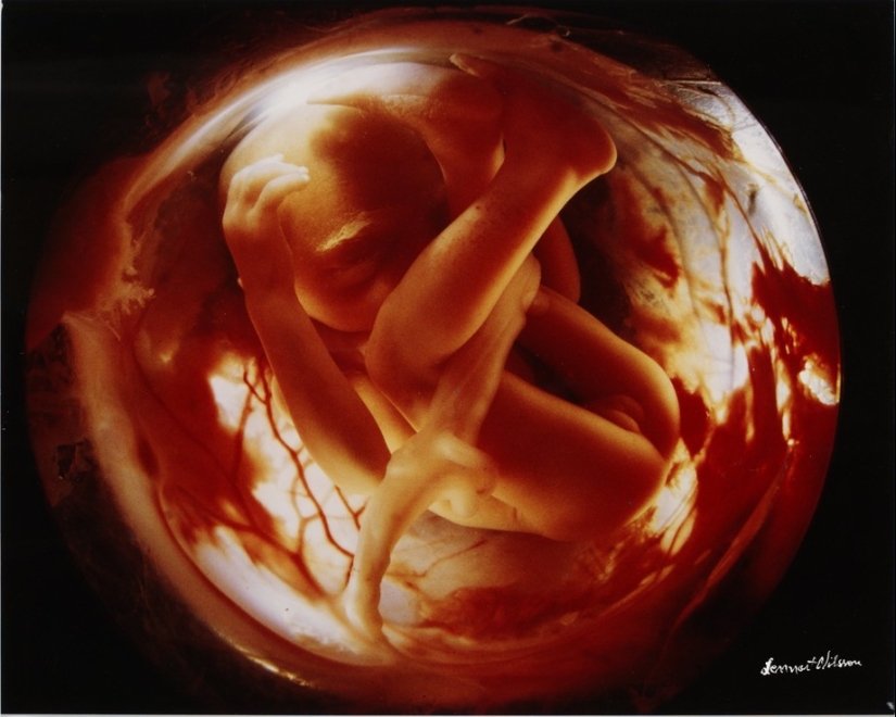 Unique footage - from conception to birth