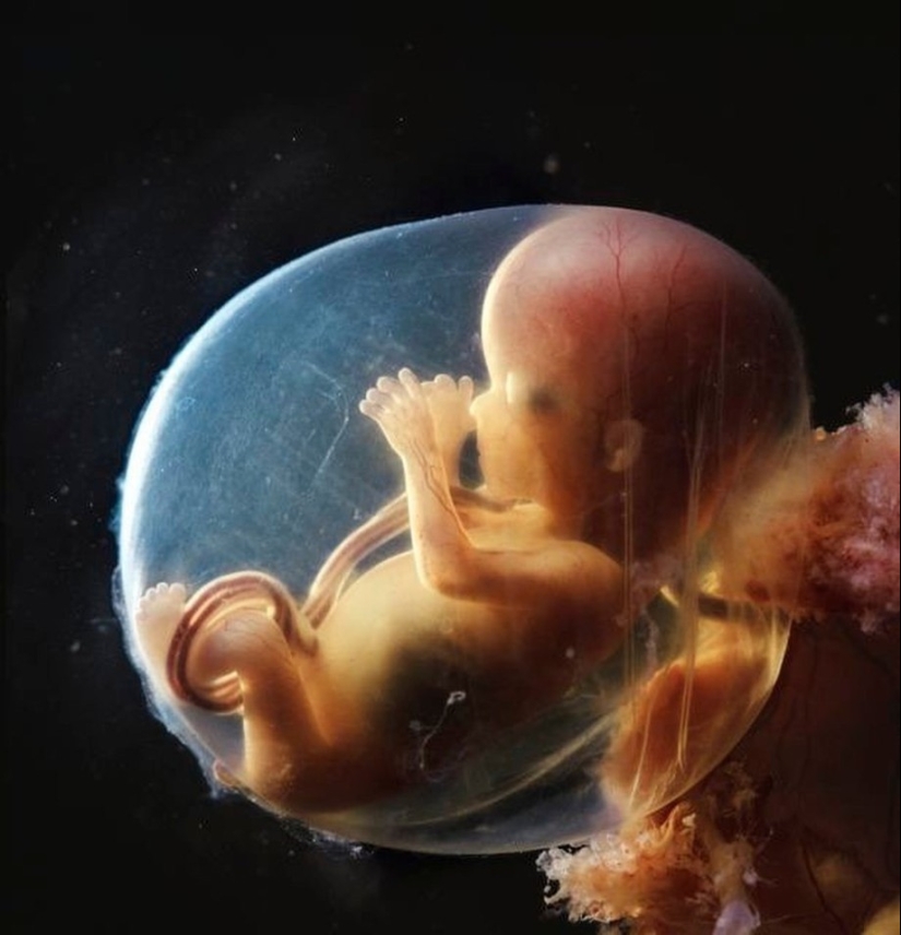 Unique footage - from conception to birth