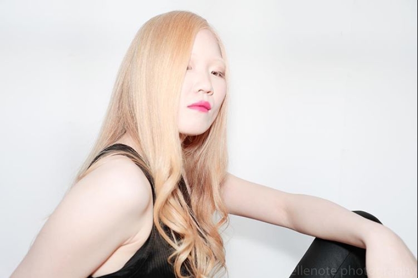 What do albinos of different nationalities and races look like