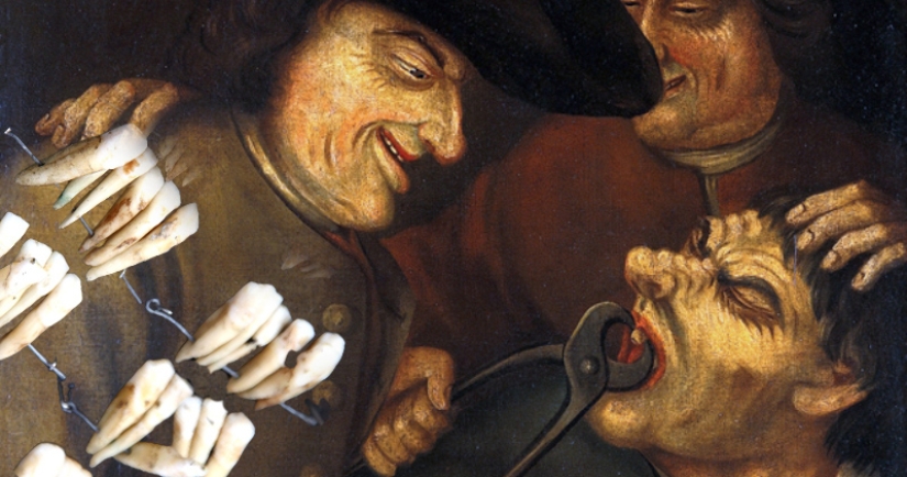 What is "Waterloo teeth", or As the battle of 1815 influenced the development of dentistry