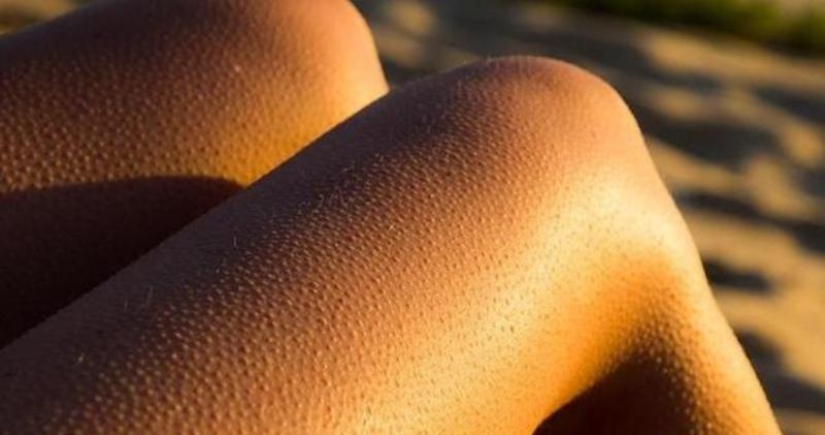 Where do goosebumps come from and why do we need them