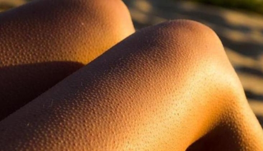 Where do goosebumps come from and why do we need them