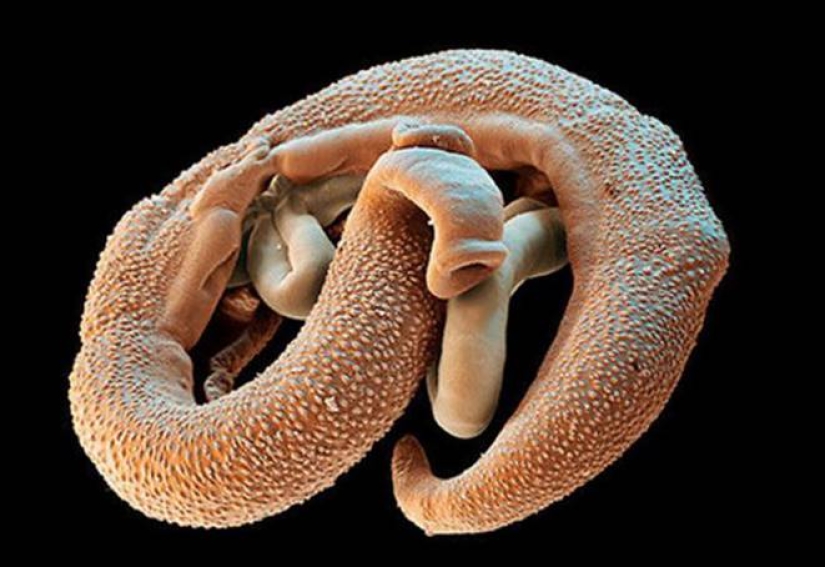 Why are cercariae dangerous - parasites from river water that penetrate the skin?