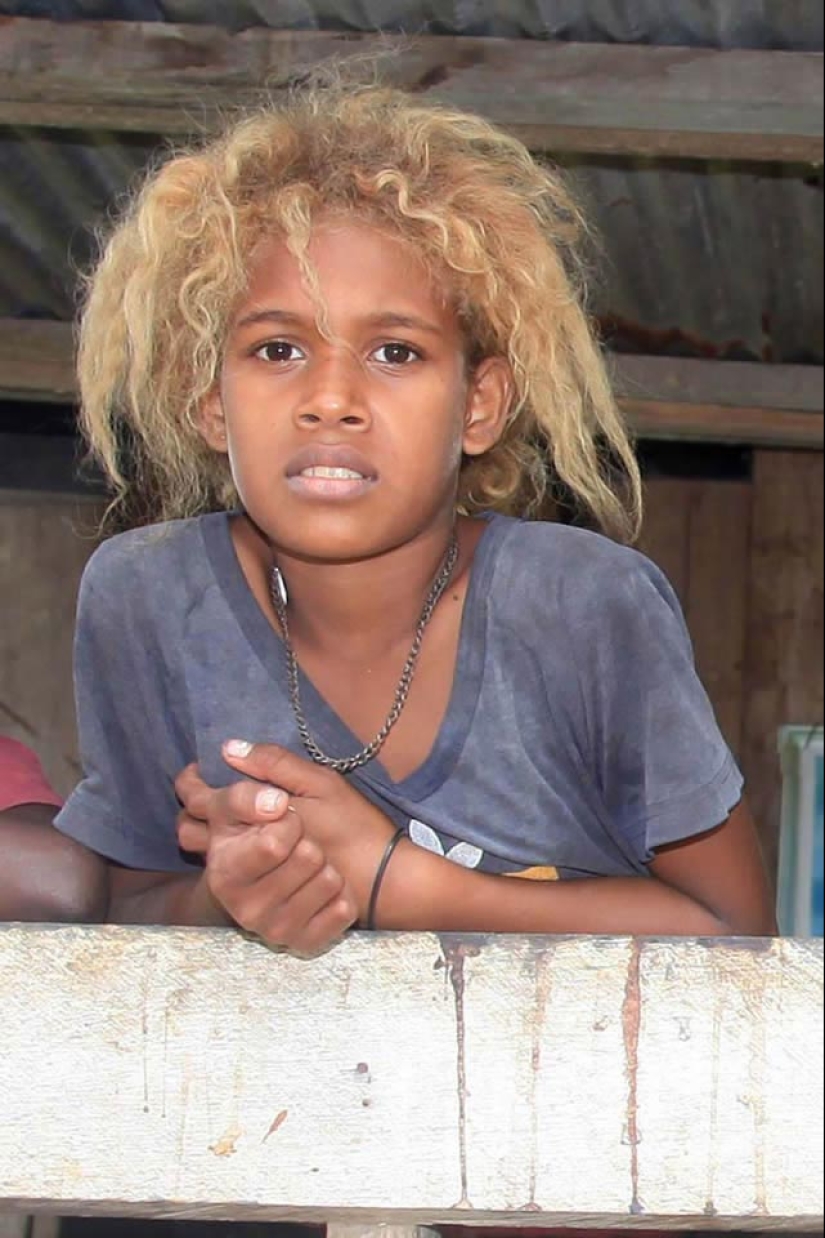 Why are dark-skinned blondes born in the Solomon Islands