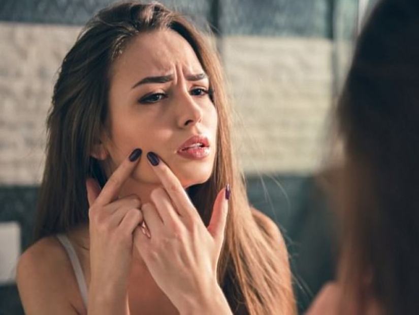 Why do people like to crush pimples so much? 5 facts about this phenomenon