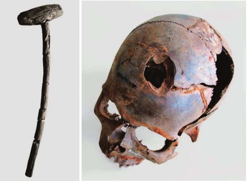 World war Bronze age: who won the first battle in European history