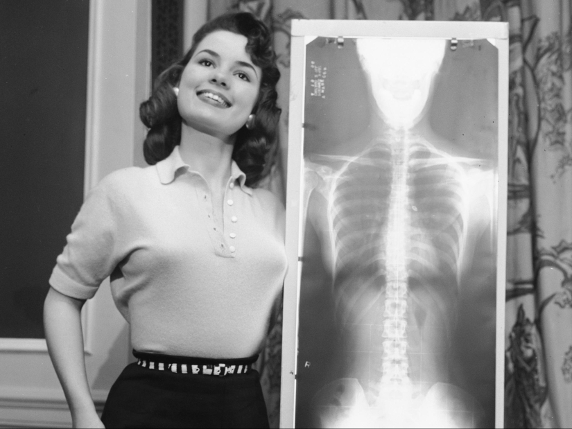 X-ray, la plomada y pesos: cómo elegir la "Señorita postura correcta" en los años 50